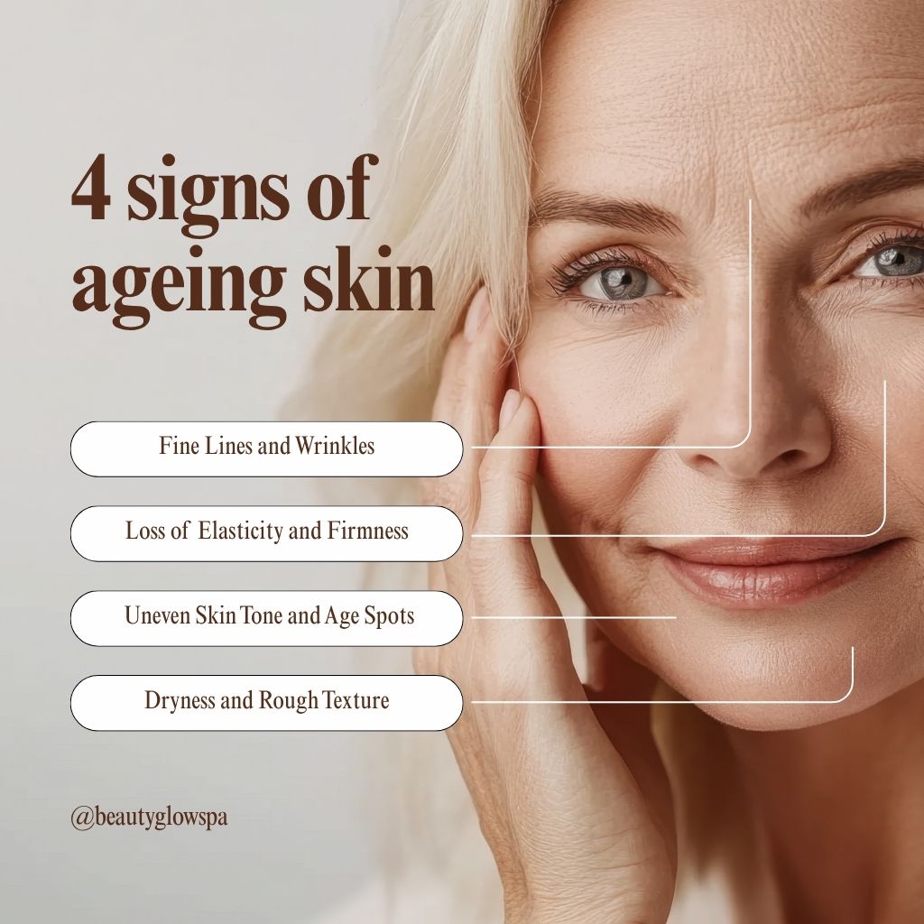 Social media marketing - agency - beaty spa